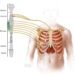 Livingston Spinal cord stimulation