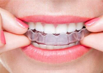 Invisalign - The Complete Guide