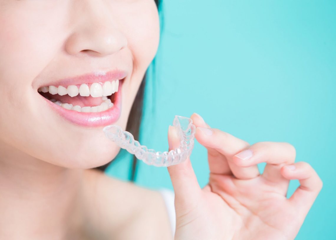 How to Get the Best Results from Your NightClear Invisible Aligners