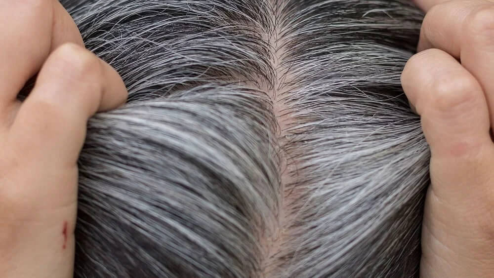 Know the Causes of White Hair and Easy Ways to Prevent it Naturally