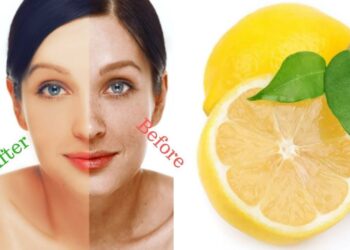 Wellhealthorganic.com Easily Remove Dark Spots Lemon Juice